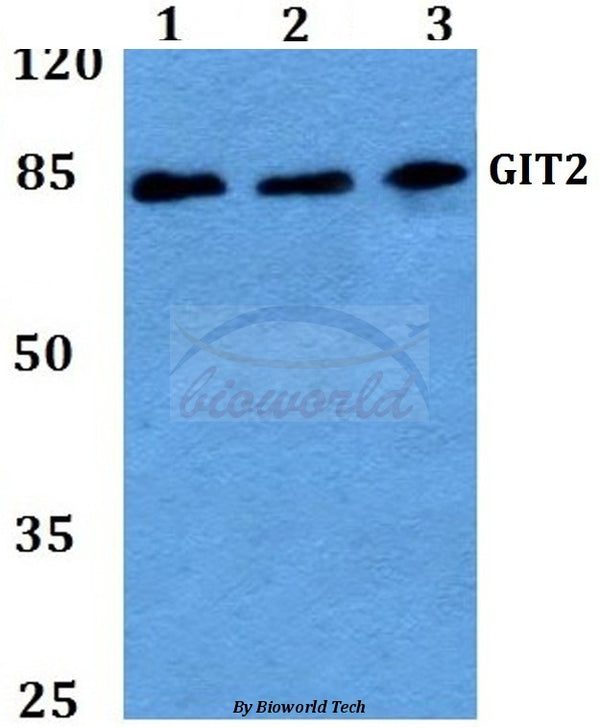 GIT2 (D391) polyclonal antibody – Figure 1 of 1