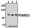 Western blot (WB) analysis of PSMD2 (R34) pAb at 1:500 dilution
Lane1:MCF-7 whole cell lysate(40ug)
Lane2:HepG2 whole cell lysate(40ug)
Lane3:HEK293T whole cell lysate(40ug)