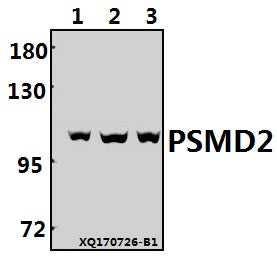 Western blot (WB) analysis of PSMD2 (R34) pAb at 1:500 dilution
Lane1:MCF-7 whole cell lysate(40ug)
Lane2:HepG2 whole cell lysate(40ug)
Lane3:HEK293T whole cell lysate(40ug)