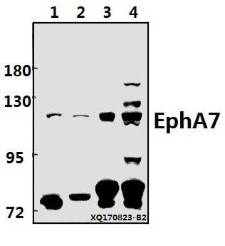 Western blot (WB) analysis of EphA7 (E477) pAb at 1:500 dilution
Lane1:3T3-L1 whole cell lysate(40ug)
Lane2:H9C2 whole cell lysate(40ug)
Lane3:A549 whole cell lysate(40ug)
Lane4:HEK293T whole cell lysate(40ug)