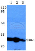 SURF-1 (F181) polyclonal antibody – Figure 1 of 1