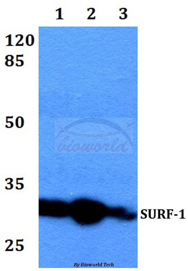 SURF-1 (F181) polyclonal antibody – Figure 1 of 1