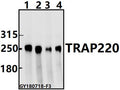 Western blot (WB) analysis of TRAP220 (P697) pAb at 1:500 dilution
Lane1:A549 whole cell lysate(40ug)
Lane2:HEK293T whole cell lysate(40ug)
Lane3:PC12 whole cell lysate(40ug)
Lane4:CT26 whole cell lysate(40ug)
