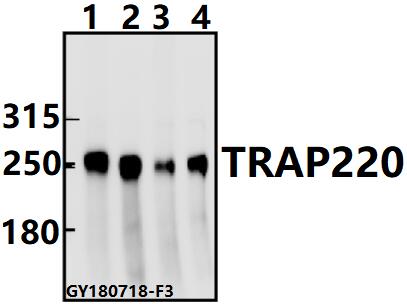 Western blot (WB) analysis of TRAP220 (P697) pAb at 1:500 dilution
Lane1:A549 whole cell lysate(40ug)
Lane2:HEK293T whole cell lysate(40ug)
Lane3:PC12 whole cell lysate(40ug)
Lane4:CT26 whole cell lysate(40ug)