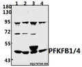 Western blot (WB) analysis of PFKFB1/4 (E349) pAb at 1:1000 dilution
Lane1:K562 whole cell lysate(40ug)
Lane2:A549 whole cell lysate(40ug)
Lane3:PC12 whole cell lysate(40ug)
Lane4:AML-12 whole cell lysate(40ug)