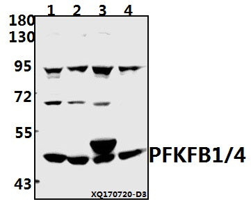 Western blot (WB) analysis of PFKFB1/4 (E349) pAb at 1:1000 dilution
Lane1:K562 whole cell lysate(40ug)
Lane2:A549 whole cell lysate(40ug)
Lane3:PC12 whole cell lysate(40ug)
Lane4:AML-12 whole cell lysate(40ug)