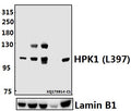 Western blot (WB) analysis of HPK1 (L397) pAb at 1:500 dilution
Lane1:HCC827 whole cell lysate(40ug)
Lane2:MCF-7 whole cell lysate(40ug)
Lane3:A549 whole cell lysate(40ug)
Lane4:H9C2 whole cell lysate(40ug)
Lane5:The Spleen tissue lysate of Mouse(40ug)