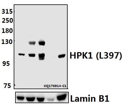 Western blot (WB) analysis of HPK1 (L397) pAb at 1:500 dilution
Lane1:HCC827 whole cell lysate(40ug)
Lane2:MCF-7 whole cell lysate(40ug)
Lane3:A549 whole cell lysate(40ug)
Lane4:H9C2 whole cell lysate(40ug)
Lane5:The Spleen tissue lysate of Mouse(40ug)