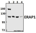 Western blot (WB) analysis of ERAP1 (K467) pAb at 1:500 dilution
Lane1:HepG2 whole cell lysate(40ug)
Lane2:HEK293T whole cell lysate(20ug)
Lane3:PC12 whole cell lysate(20ug)
Lane4:AML-12 whole cell lysate(40ug)