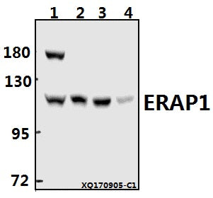 Western blot (WB) analysis of ERAP1 (K467) pAb at 1:500 dilution
Lane1:HepG2 whole cell lysate(40ug)
Lane2:HEK293T whole cell lysate(20ug)
Lane3:PC12 whole cell lysate(20ug)
Lane4:AML-12 whole cell lysate(40ug)