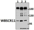 Western blot (WB) analysis of WBSCR11 (K94) pAb at 1:1000 dilution
Lane1:L02 whole cell lysate(10ug)
Lane2:HepG2 whole cell lysate(10ug)
Lane3:MCF-7 whole cell lysate(10ug)