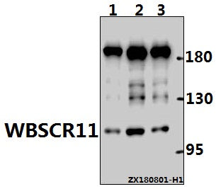 Western blot (WB) analysis of WBSCR11 (K94) pAb at 1:1000 dilution
Lane1:L02 whole cell lysate(10ug)
Lane2:HepG2 whole cell lysate(10ug)
Lane3:MCF-7 whole cell lysate(10ug)