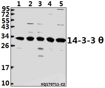 Western blot (WB) analysis of 14-3-3 θ (Q67) pAb at 1:500 dilution
Lane1:K562 whole cell lysate(40ug)
Lane2:HepG2 whole cell lysate(40ug)
Lane3:A549 whole cell lysate(40ug)
Lane4:HEK293T whole cell lysate(40ug)
Lane5:U-87MG whole cell lysate(40ug)