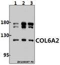 Western blot (WB) analysis of COL6A2 (Y711) pAb at 1:1000 dilution
Lane1:U-87MG whole cell lysate(40ug)
Lane2:PC3 whole cell lysate(40ug)
Lane3:MCF-7 whole cell lysate(40ug)