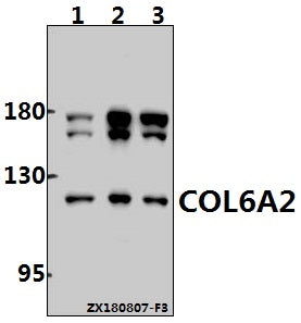 Western blot (WB) analysis of COL6A2 (Y711) pAb at 1:1000 dilution
Lane1:U-87MG whole cell lysate(40ug)
Lane2:PC3 whole cell lysate(40ug)
Lane3:MCF-7 whole cell lysate(40ug)