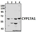 Western blot (WB) analysis of CYP17A1 (N249) pAb at 1:500 dilution
Lane1:MCF-7 whole cell lysate(40ug)
Lane2:A2780 whole cell lysate(40ug)
Lane3:PC3 whole cell lysate(40ug)
Lane4:HEK293T whole cell lysate(40ug)
