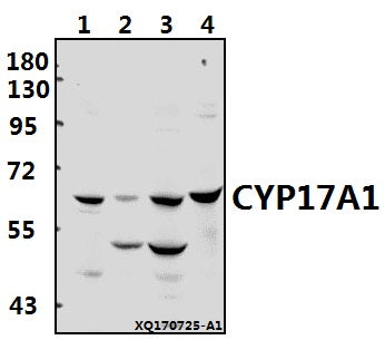 Western blot (WB) analysis of CYP17A1 (N249) pAb at 1:500 dilution
Lane1:MCF-7 whole cell lysate(40ug)
Lane2:A2780 whole cell lysate(40ug)
Lane3:PC3 whole cell lysate(40ug)
Lane4:HEK293T whole cell lysate(40ug)
