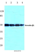Arrestin-β-1 (Q394) polyclonal antibody – Figure 1 of 1