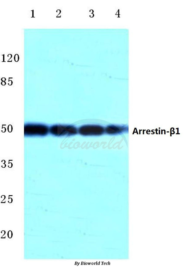 Arrestin-β-1 (Q394) polyclonal antibody – Figure 1 of 1