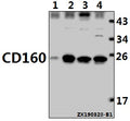 Western blot (WB) analysis of CD160 pAb at 1:1000 dilution
Lane1:RAW264.7 whole cell lysate(40ug)
Lane2:K562 whole cell lysate(40ug)
Lane3:Jurkat whole cell lysate(40ug)
Lane4:Myla2059 whole cell lysate(40ug)
