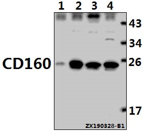Western blot (WB) analysis of CD160 pAb at 1:1000 dilution
Lane1:RAW264.7 whole cell lysate(40ug)
Lane2:K562 whole cell lysate(40ug)
Lane3:Jurkat whole cell lysate(40ug)
Lane4:Myla2059 whole cell lysate(40ug)