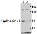 Western blot (WB) analysis of Cadherin-7 (R678) pAb at 1:500 dilution
Lane1:The Brain tissue lysate of Mouse(40ug)
Lane2:The Brain tissue lysate of Rat(40ug)