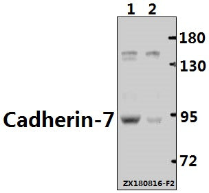 Western blot (WB) analysis of Cadherin-7 (R678) pAb at 1:500 dilution
Lane1:The Brain tissue lysate of Mouse(40ug)
Lane2:The Brain tissue lysate of Rat(40ug)