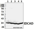 Western blot (WB) analysis of IDCAD (Q177) polyclonal antibody at 1:500 dilution
Lane1:C6 whole cell lysate(40ug)
Lane2:CT26 whole cell lysate(40ug)
Lane3:HCT116 whole cell lysate(40ug)
Lane4:COS-7 whole cell lysate(40ug)
Lane5:SGC7901 whole cell lysate(40ug)