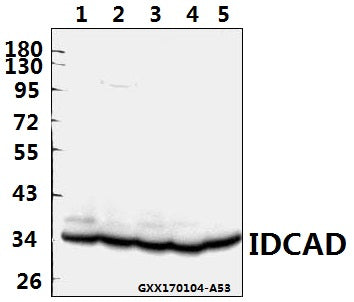 Western blot (WB) analysis of IDCAD (Q177) polyclonal antibody at 1:500 dilution
Lane1:C6 whole cell lysate(40ug)
Lane2:CT26 whole cell lysate(40ug)
Lane3:HCT116 whole cell lysate(40ug)
Lane4:COS-7 whole cell lysate(40ug)
Lane5:SGC7901 whole cell lysate(40ug)