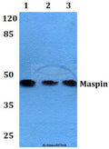 Maspin (T118) polyclonal antibody – Figure 1 of 1