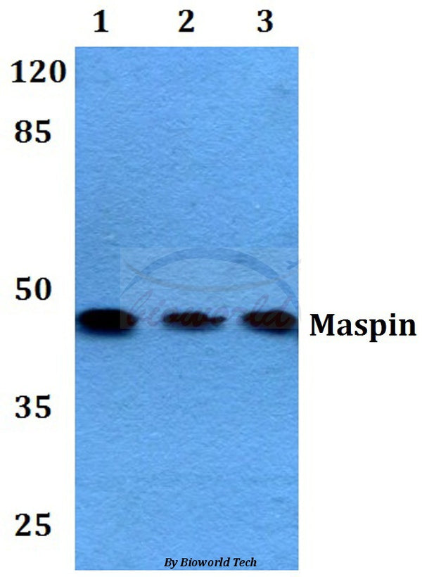 Maspin (T118) polyclonal antibody – Figure 1 of 1
