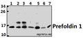 Western blot (WB) analysis of Prefoldin 1 (E35) polyclonal antibody at 1:500 dilution
Lane1:K562 whole cell lysate(40ug)
Lane2:HepG2 whole cell lysate(40ug)
Lane3:A549 whole cell lysate(40ug)
Lane4:U-87MG whole cell lysate(40ug)
Lane5:HEK293T whole cell lysate(40ug)
Lane6:H9C2 whole cell lysate(40ug)
Lane7:CT-26 whole cell lysate(40ug)