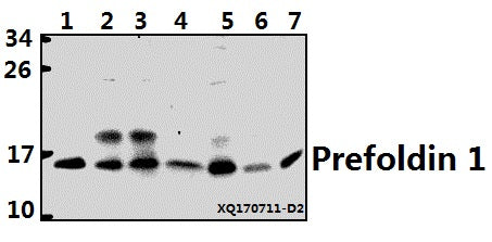 Western blot (WB) analysis of Prefoldin 1 (E35) polyclonal antibody at 1:500 dilution
Lane1:K562 whole cell lysate(40ug)
Lane2:HepG2 whole cell lysate(40ug)
Lane3:A549 whole cell lysate(40ug)
Lane4:U-87MG whole cell lysate(40ug)
Lane5:HEK293T whole cell lysate(40ug)
Lane6:H9C2 whole cell lysate(40ug)
Lane7:CT-26 whole cell lysate(40ug)