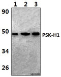 PSK-H1 (M295) polyclonal antibody – Figure 1 of 1