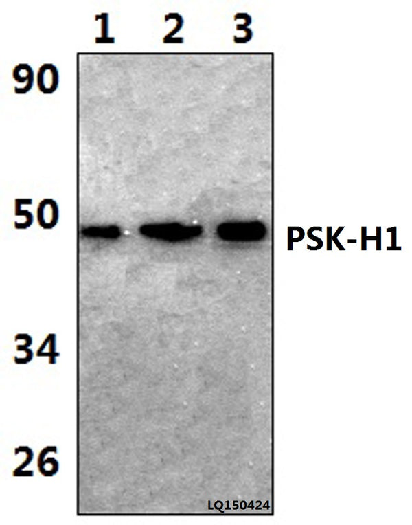 PSK-H1 (M295) polyclonal antibody – Figure 1 of 1