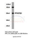 Western blot (WB) analysis of PFKFB1 (E442) polyclonal antibody in extracts from hela cells.