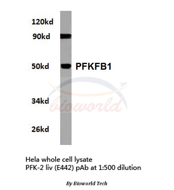 Western blot (WB) analysis of PFKFB1 (E442) polyclonal antibody in extracts from hela cells.
