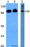 LTK (R241) polyclonal antibody – Figure 1 of 1