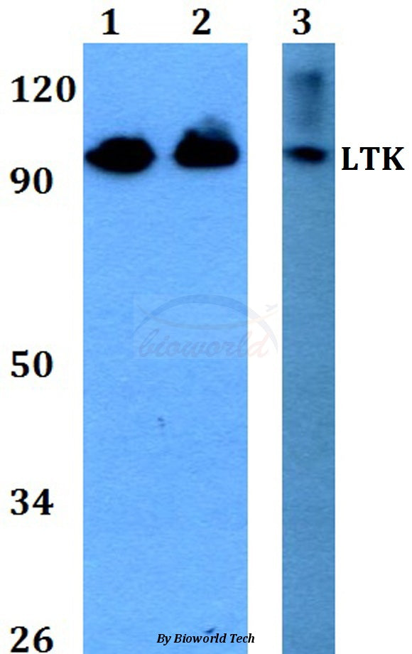 LTK (R241) polyclonal antibody – Figure 1 of 1