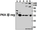 Western blot (WB) analysis of PKA Iβ reg (F138) pAb at 1:500 dilution
Lane1:The Brain tissue lysate of Mouse(10ug)
Lane2:The Brain tissue lysate of Rat(20ug)
Lane3:MCF-7 whole cell lysate(40ug)
Lane4:A549 whole cell lysate(40ug)
Lane5:K562 whole cell lysate(40ug)