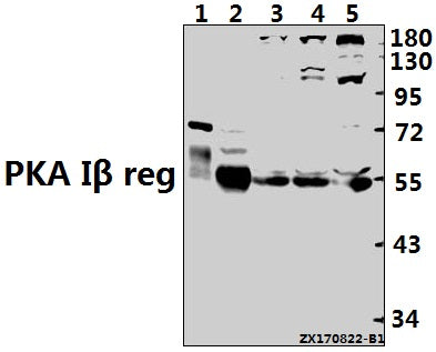 Western blot (WB) analysis of PKA Iβ reg (F138) pAb at 1:500 dilution
Lane1:The Brain tissue lysate of Mouse(10ug)
Lane2:The Brain tissue lysate of Rat(20ug)
Lane3:MCF-7 whole cell lysate(40ug)
Lane4:A549 whole cell lysate(40ug)
Lane5:K562 whole cell lysate(40ug)