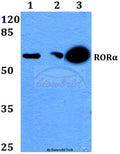 RORα (G41) polyclonal antibody – Figure 1 of 1