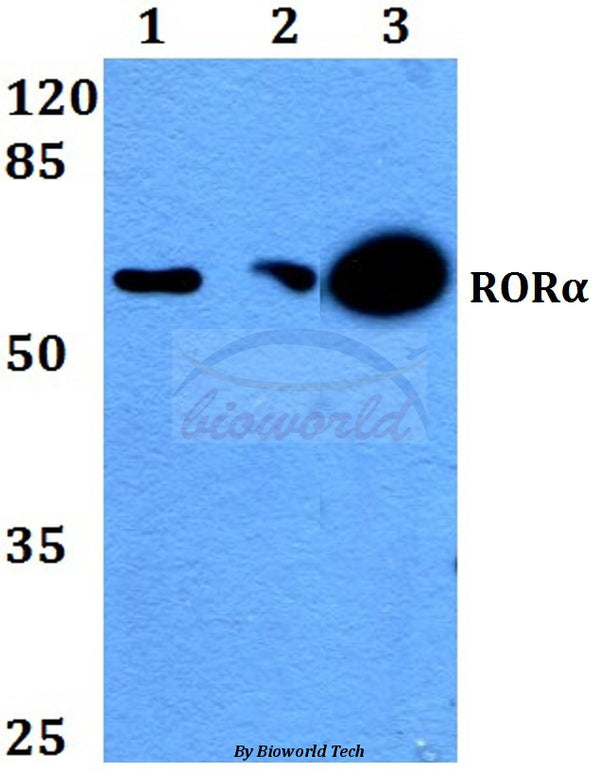 RORα (G41) polyclonal antibody – Figure 1 of 1