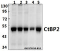 Western blot (WB) analysis of CtBP2 (P432) polyclonal antibody at 1:500 dilution
Lane1:PC3 whole cell lysate(40ug)
Lane2:H1792 whole cell lysate(40ug)
Lane3:Panc1 whole cell lysate(40ug)
Lane4:H9C2 whole cell lysate(40ug)
Lane5:AML-12 whole cell lysate(40ug)