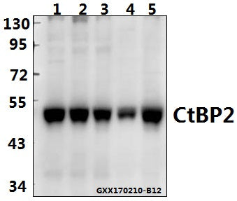 Western blot (WB) analysis of CtBP2 (P432) polyclonal antibody at 1:500 dilution
Lane1:PC3 whole cell lysate(40ug)
Lane2:H1792 whole cell lysate(40ug)
Lane3:Panc1 whole cell lysate(40ug)
Lane4:H9C2 whole cell lysate(40ug)
Lane5:AML-12 whole cell lysate(40ug)