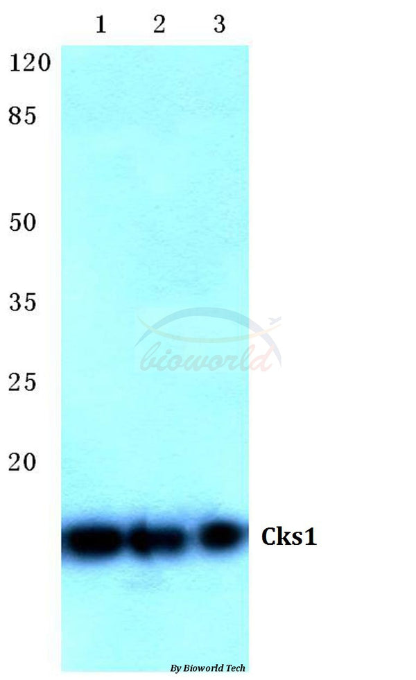 Cks1 (H3) polyclonal antibody – Figure 1 of 1
