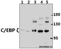 Western blot (WB) analysis of C/EBP ζ (D24) pAb at 1:500 dilution
Lane1:PC12 whole cell lysate(40ug)
Lane2:3T3-L1 whole cell lysate(40ug)
Lane3:A2780 whole cell lysate(40ug)
Lane4:Hela whole cell lysate(40ug)
Lane5:MCF-7 whole cell lysate(40ug)