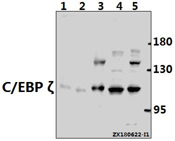 Western blot (WB) analysis of C/EBP ζ (D24) pAb at 1:500 dilution
Lane1:PC12 whole cell lysate(40ug)
Lane2:3T3-L1 whole cell lysate(40ug)
Lane3:A2780 whole cell lysate(40ug)
Lane4:Hela whole cell lysate(40ug)
Lane5:MCF-7 whole cell lysate(40ug)