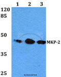 MKP-2 (Y108) polyclonal antibody – Figure 1 of 1