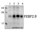 Western blot (WB) analysis of PEBP2β (R33) polyclonal antibody at 1:500 dilution
Lane1:L02 whole cell lysate(40ug)
Lane2:HEK293T whole cell lysate(40ug)
Lane3:A549 whole cell lysate(40ug)
Lane4:SGC-7901 whole cell lysate(40ug)